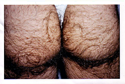 Fil:Hairy-butt.jpg