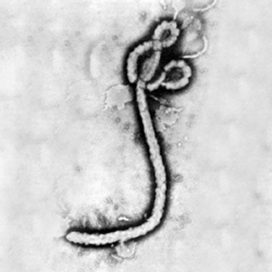Fil:Ebola virus 1.jpg