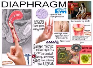 Diaphragm.jpg